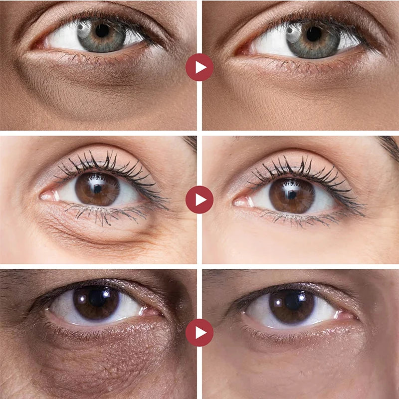 Rejuvenecedor de olhos Vitamina C e ácido Hyaluronic- Firma a pele, reduz rugas e olheira