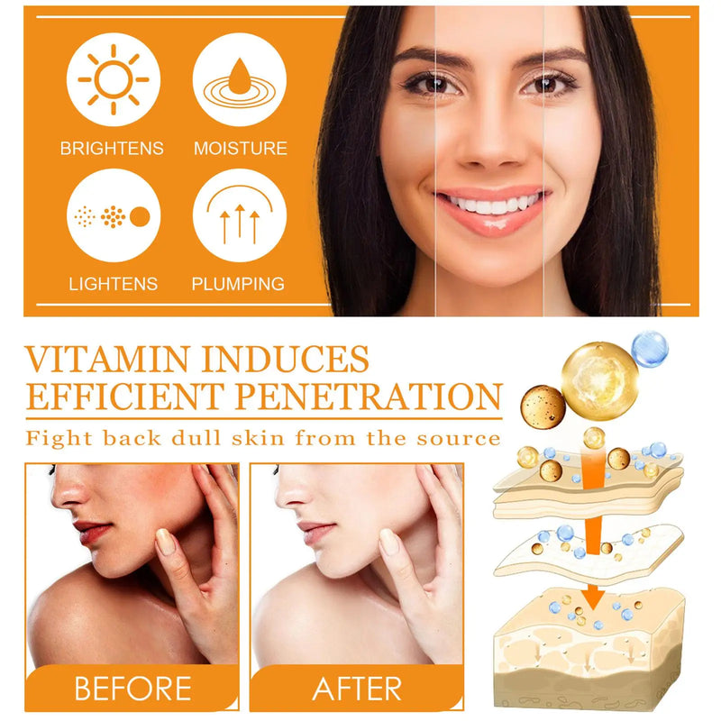 Soro de vitamina C com ácido hialurónico removedor de manchas escuras